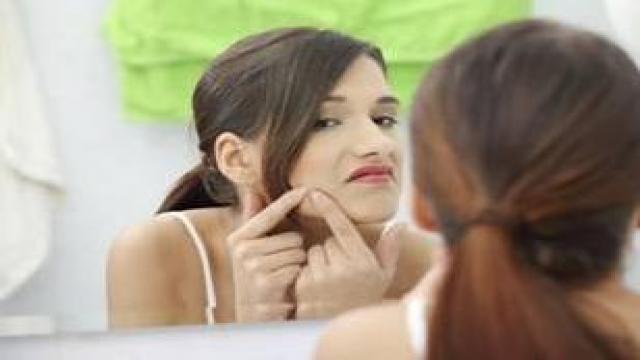 Akne nedir? Nasıl tedavi edilir?