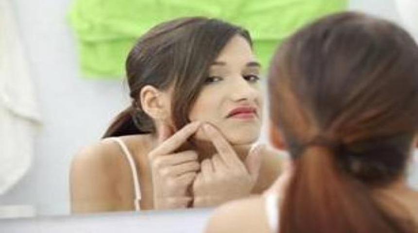 Akne nedir? Nasıl tedavi edilir?