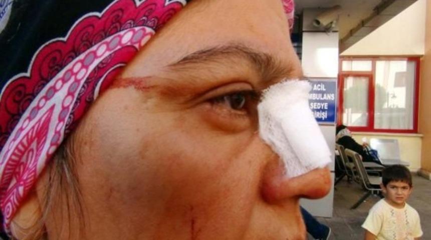 Dayak mağduru kadın koruma istiyor