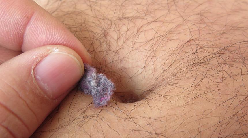 Göbek deliği hakkında şaşırtıcı gerçekler: Eğer kaşınıyorsa...