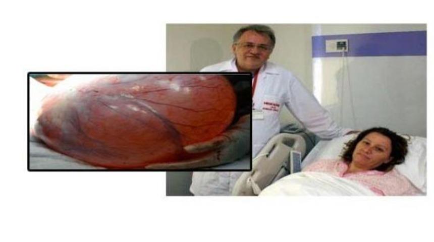 Ordu'da karnından dev kitle çıktı!