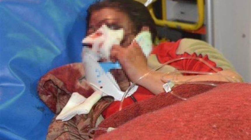 Sakarya'da sınıf öğretmeni Hanife A.'yı feci şekilde dövdüler