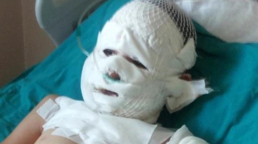 İftar i&ccedil;in atılan ses bombası, parkta oynayan &ccedil;ocuğu ağır yaraladı