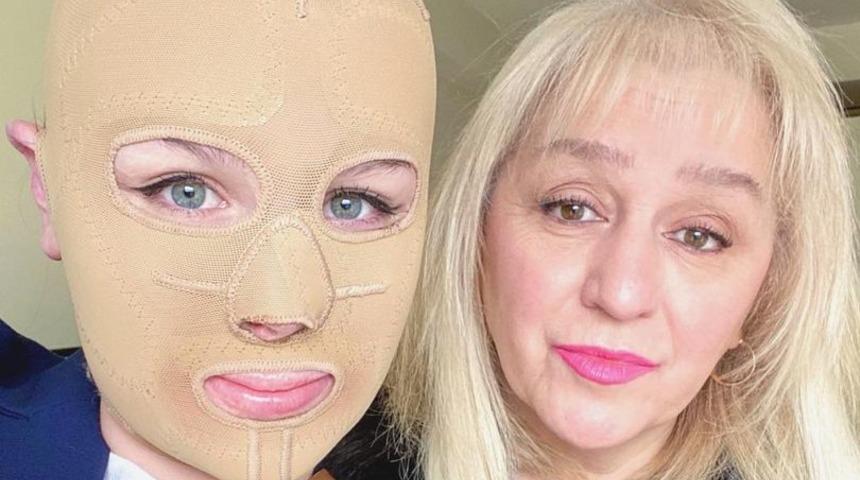 Volkanik patlamada babası ve kız kardeşini kaybetti! Yaşadıklarını TikTok hesabından anlattı: Hayatta kaldım ama...