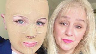 Volkanik patlamada babası ve kız kardeşini kaybetti! Yaşadıklarını TikTok hesabından anlattı: Hayatta kaldım ama...