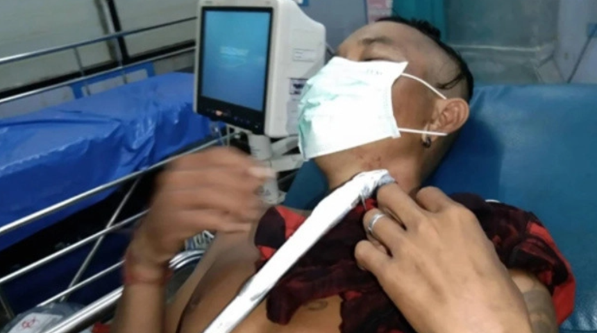 Denizde yüzdüğü sırada boynuna zargana saplandı! Güçlükle hastaneye kaldırıldı