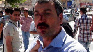 Fakıbaba ile görüşmek isteyen vatandaşa dayak