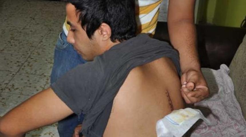 Sırtındaki cam par&ccedil;ası 2,5 ay sonra belirlendi