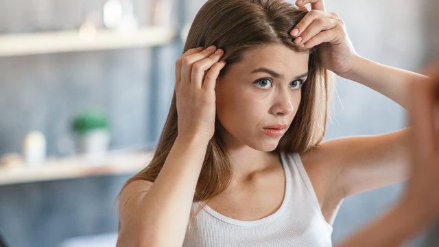 Kepekli saç görünümünden kurtulmak için 