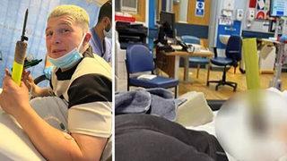 Dehşet veren olay! Korner direği bacağına girdi