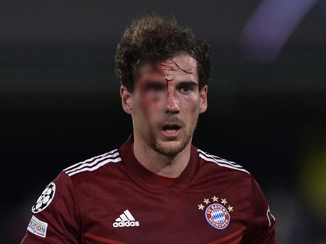 Geceye damga vuran an! Leon Goretzka kanlar içinde yerde kaldı...