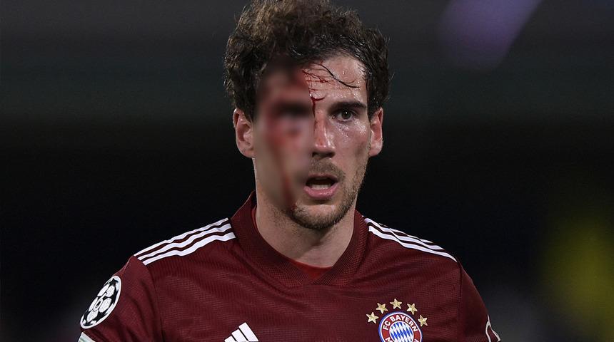 Geceye damga vuran an! Leon Goretzka kanlar içinde yerde kaldı...
