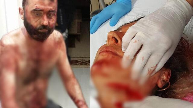 Antalya'da maket bıçaklı dehşet! Eski eşine ve kocasını tanınmaz hale getirmişti... Uzaklaştırma kararı varmış