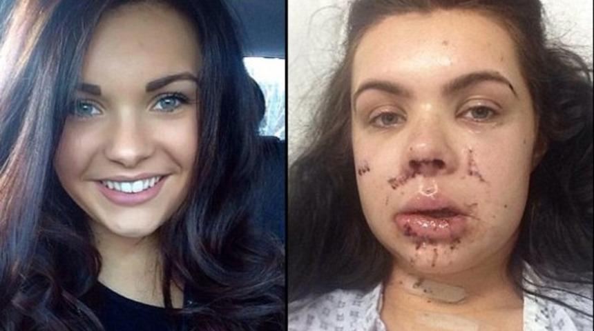 Aracında saldırıya uğrayan kadın tanınmayacak hale geldi