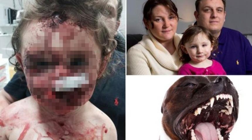 18 aylık bebeği bu hale getirdi