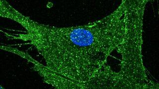 İngiltere'de deri hücresi 30 yıl gençleştirildi: 'Amaç sağlıklı yaşam süresini uzatmak'