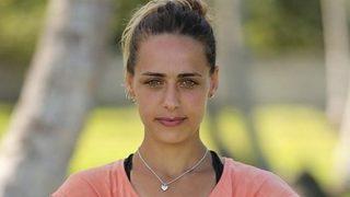 Estetikten önce estetikten sonra! Survivor Damla'nın estetiksiz hali pes dedirtti