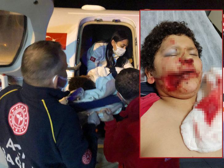 Bisikletle direğe çarpan Serdar, kabusu yaşadı! Yanağından kopan parça, Antalya'da dikildi