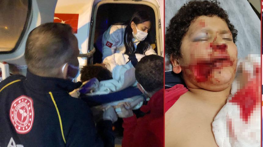 Bisikletle direğe &ccedil;arpan Serdar, kabusu yaşadı! Yanağından kopan par&ccedil;a, Antalya'da dikildi