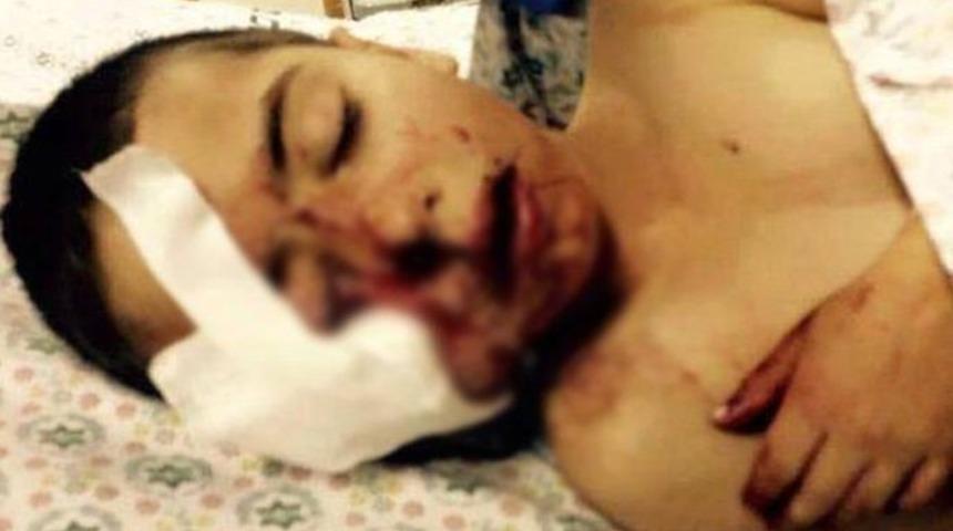 İsrail 5 yaşındaki çocuğu suratından vurdu