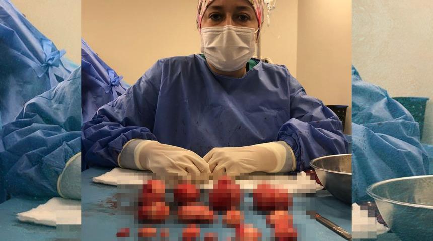 Çocuk sahibi olamayınca hastaneye başvurdu! Rahminden çıkarılanlar şoke etti