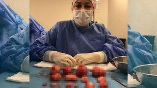 Çocuk sahibi olamayınca hastaneye başvurdu! Rahminden çıkarılanlar şoke etti