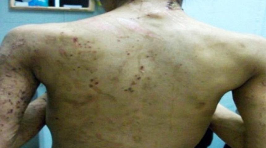 Ka&ccedil;ırıldı, k&ouml;le yapıldı, boynundan masaya zincirlendi