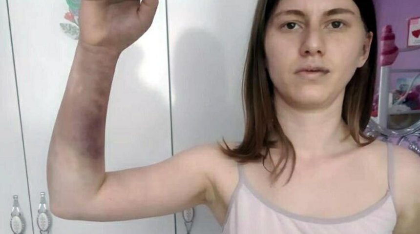 Zeynep'i 'başka erkeğin fotoğrafını beğendin' deyip beyzbol sopasıyla dövmüştü! Bir dava daha