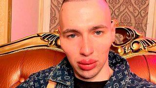 Estetik ameliyatlarının sayısını unuttu! Uzaylıya benzemek için defalarca bıçak altına yattı