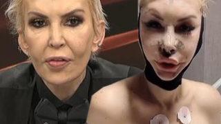 10 ameliyat geçirip 1 milyon lira harcayan Seyhan Soylu şaşkına çevirdi