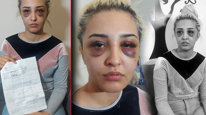 Bir suç duyurusu da cinsel saldırıdan! Kan donduran detaylar ortaya çıktı: 'Dövdükten sonra...'