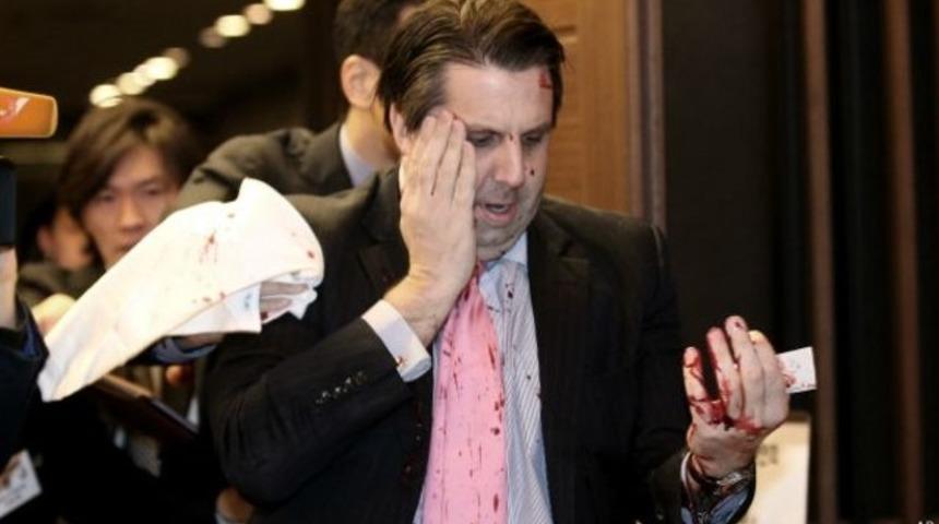 ABD'nin G&uuml;ney Kore B&uuml;y&uuml;kel&ccedil;isi usturalı saldırıya uğradı