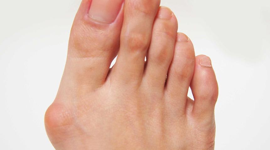 Yanlış giden ameliyatın ardından ‘aşk hayatının etkileneceği’ gerekçesiyle 75.000 pound tazminat aldı!