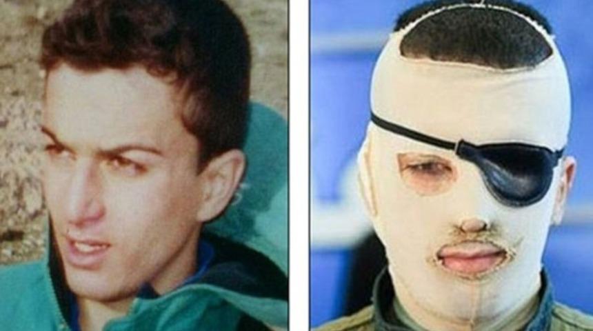 Kezzap atana mahkeme 'kısasa kısas' dedi