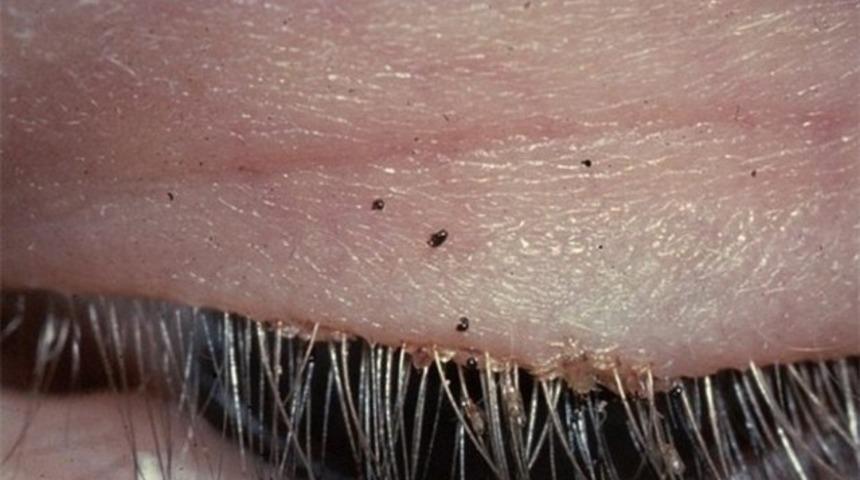 Doktorları dehşete düşüren görüntü