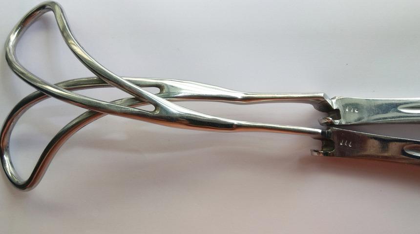 Cinsel organından çıktı: Tam 80 cm! Nedeni 'pes' dedirtti