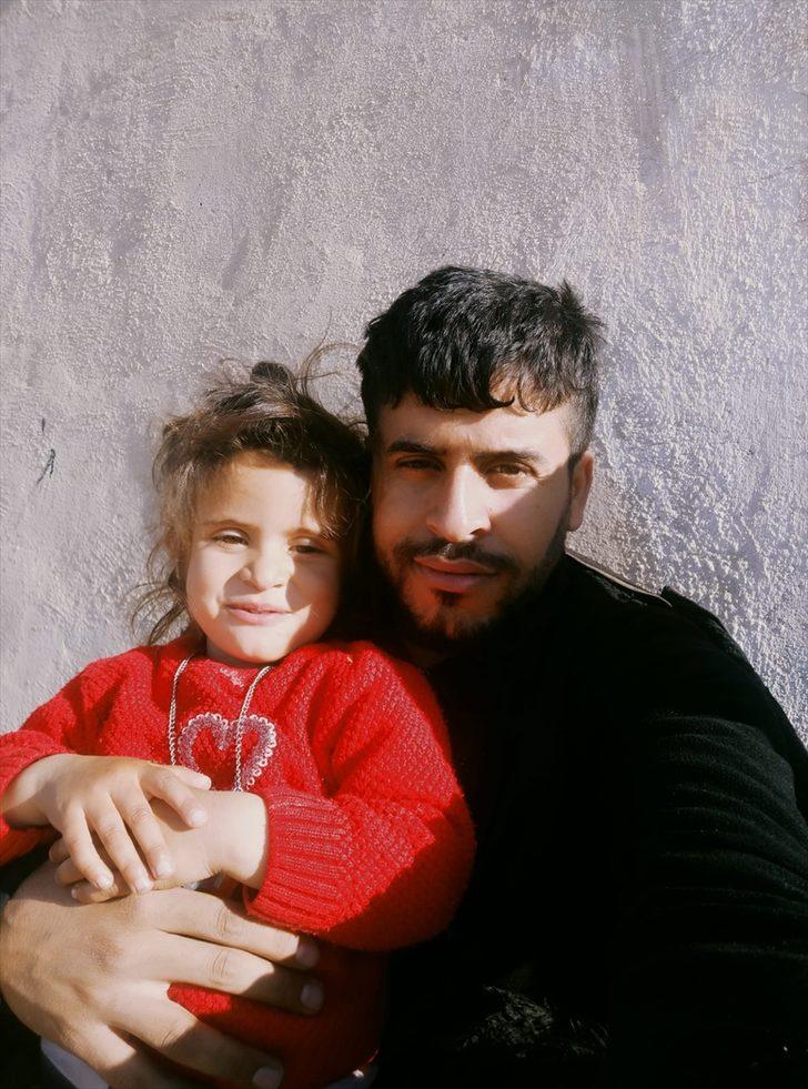 Eşeğin ısırdığı çocuğa boyun bölgesindeki dokudan göz kapağı yapıldı G2