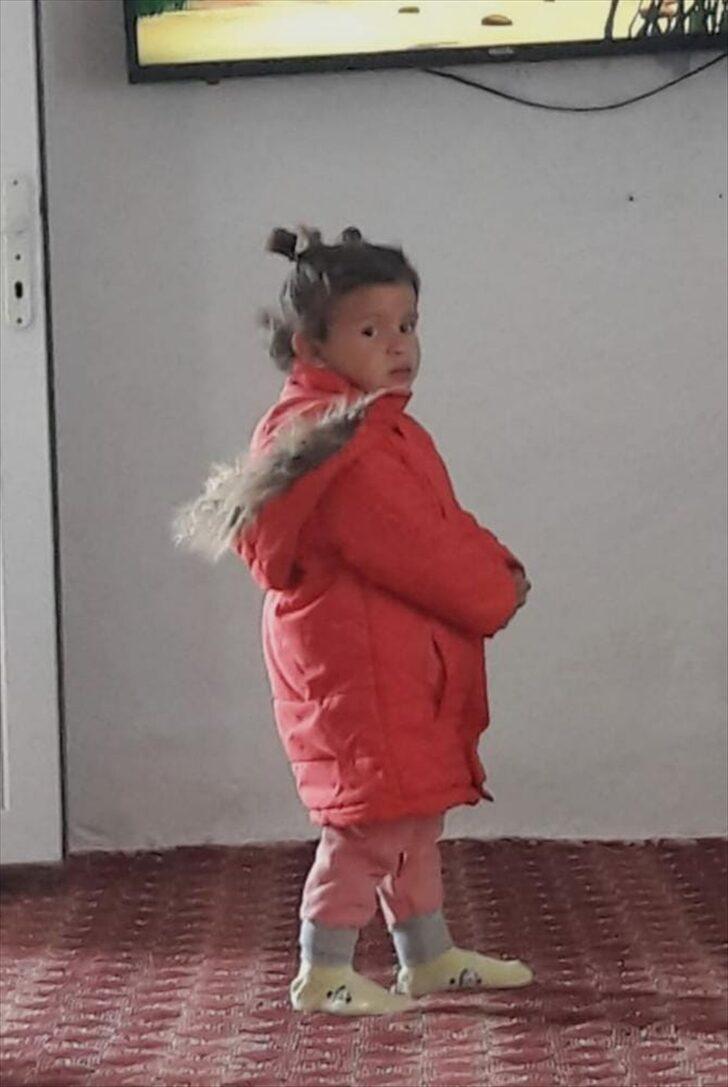 Eşeğin ısırdığı çocuğa boyun bölgesindeki dokudan göz kapağı yapıldı G3