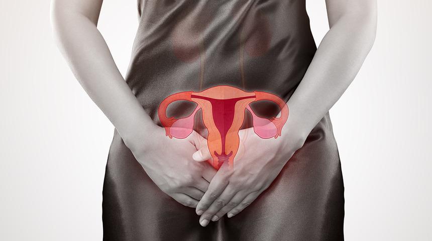 Her 4 kadından 1’inde görülüyor! Miyomlar hakkında tüm bilgiler 