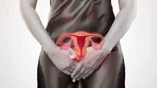 Her 4 kadından 1’inde görülüyor! Miyomlar hakkında tüm bilgiler 