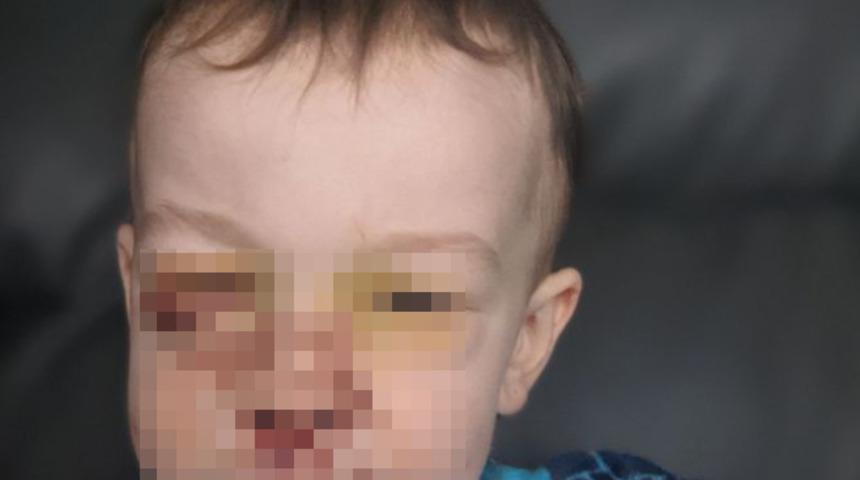 Aile köpekleri 2 yaşındaki çocuklarına saldırınca dehşeti yaşadılar! “Her yer kan içindeydi”