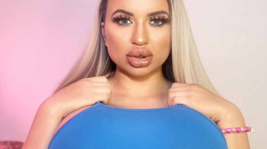 Estetik ameliyat bağımlılığı bulunan OnlyFans fenomeni herkesi şaşırttı! “Ailem beni reddetti”