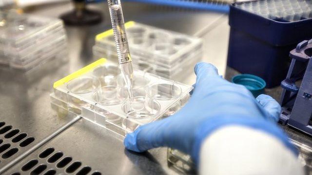 TARIM VE ORMAN BAKANLIĞI NOKTAYI KOYDU! Salmonella virüsü nedir? Salmonella virüsü nasıl bulaşır? Salmonella virüsü belirtileri nelerdir?