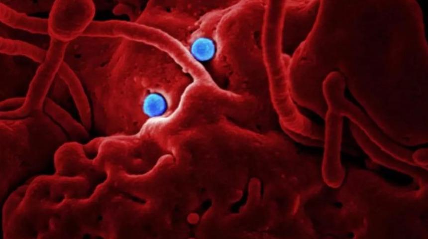 Gizemli virüs alarmı! Yayılmaya başladı