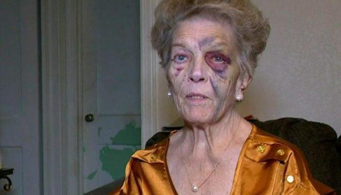 72 yaşındaki kadını dövüp arabasını çalan hırsızın sonu felaketle bitti! Çaldığı arabayla kaza yaptı