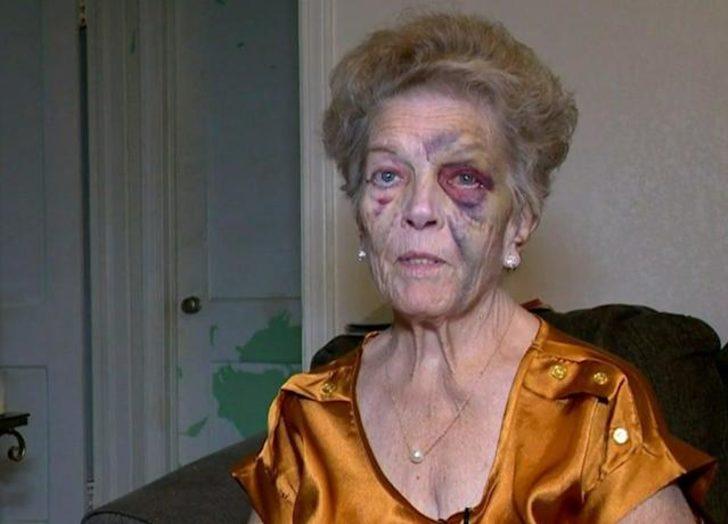 72 yaşındaki kadını dövüp arabasını çalan hırsızın sonu felaketle bitti! Çaldığı arabayla kaza yaptı