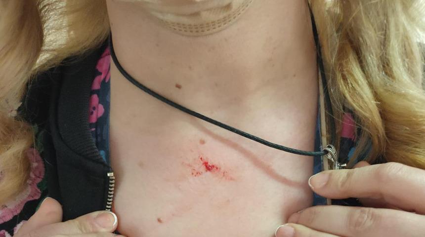 Kayseri'de akılalmaz olay! 68 yaşındaki kadın, sağlık çalışanını darbetti