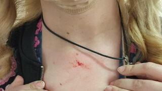 Kayseri'de akılalmaz olay! 68 yaşındaki kadın, sağlık çalışanını darbetti