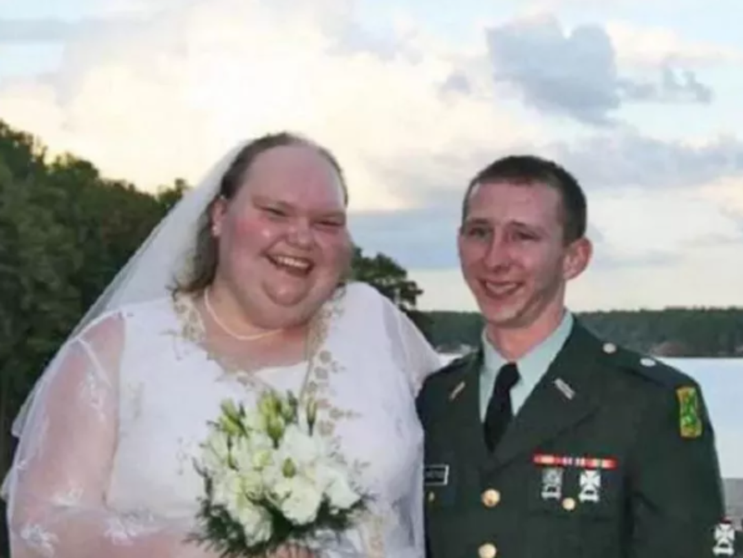 D&uuml;nyanın en &ccedil;irkin gelini diyorlardı! Son halini g&ouml;ren inanamadı