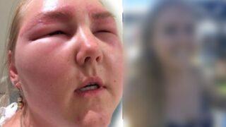 Gelin olamadan hastanelik oldu! Yüzü tamamen değişti